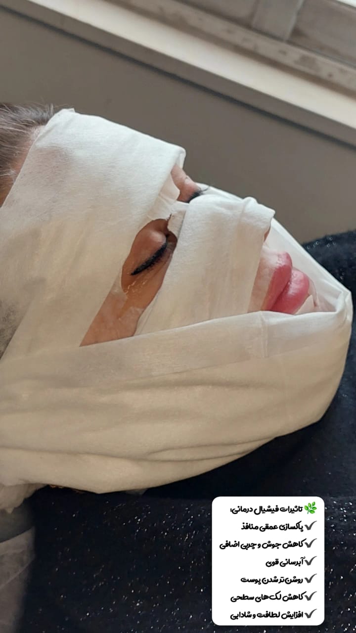 خدمات پاکسازی و درمان پوست یلدا اکبری در شیراز